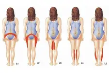 Bel Fıtığı Ağrısı Belirtileri ve Tedavisi